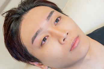 ビフォーアフター 施術例4