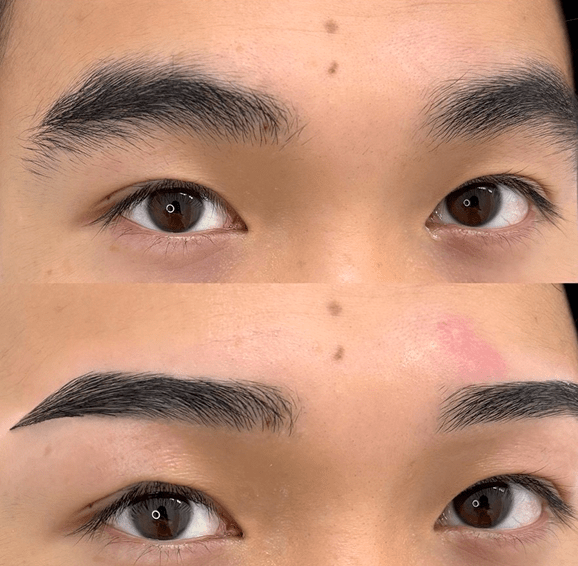 平行ストレート