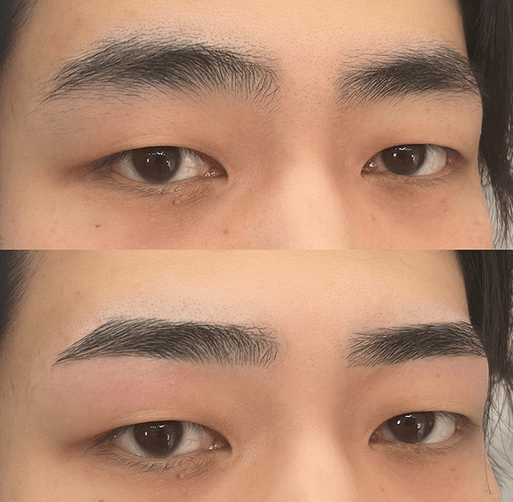 平行ストレート